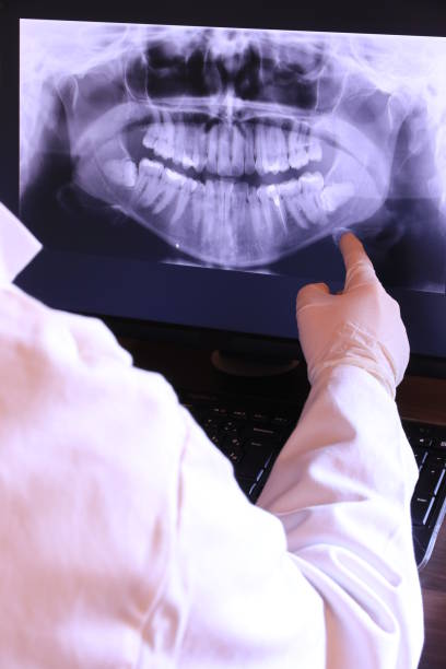 Best Emergency Root Canal Treatment in Newport News, VA