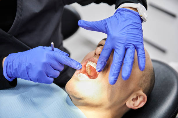 Best Emergency Wisdom Teeth Removal in Newport News, VA