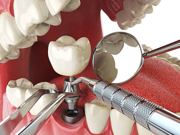 Best After-Hours Emergency Dentist in Newport News, VA