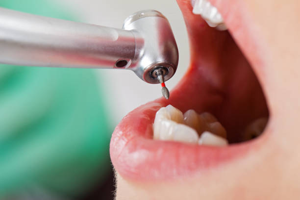 Best Emergency Dental Surgery in Newport News, VA